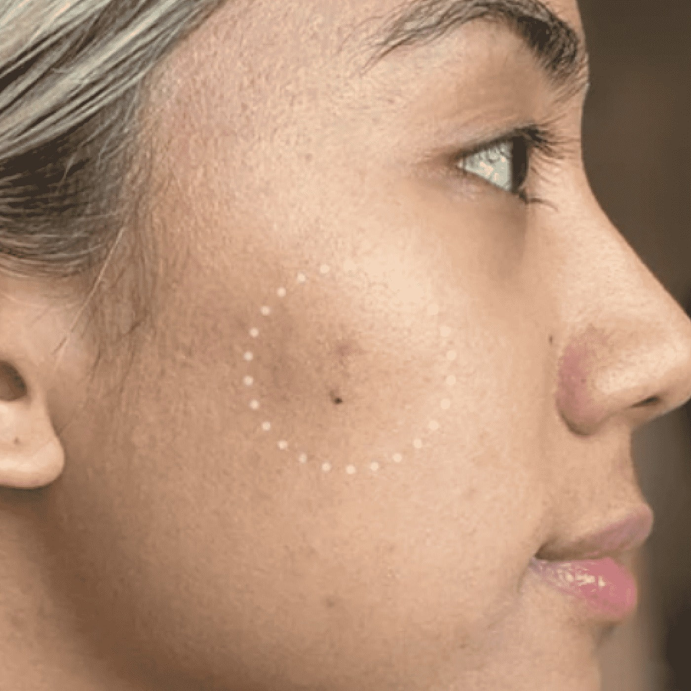Mighty PatchTM for Dark Spots