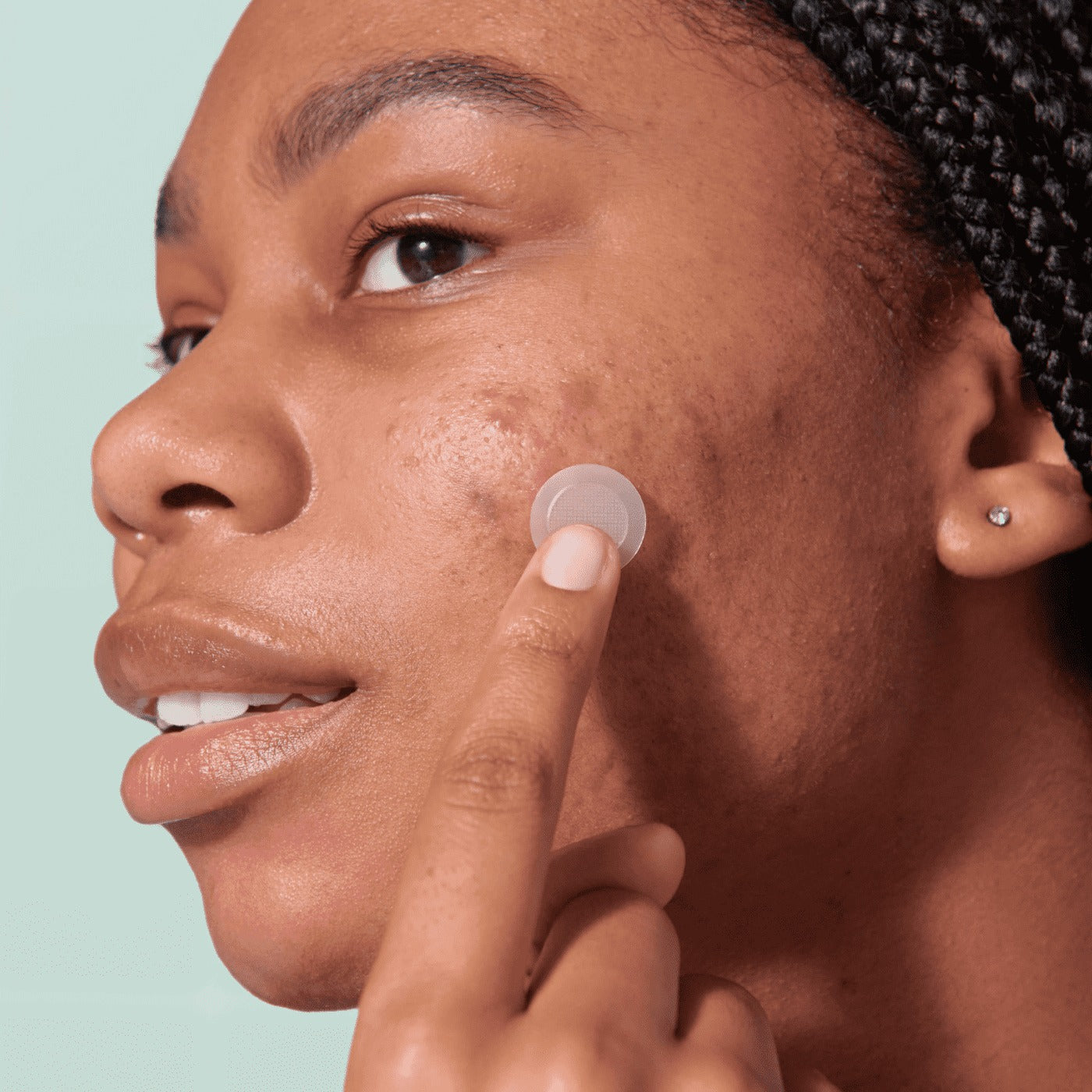 Mighty PatchTM for Early-Stage Blemishes